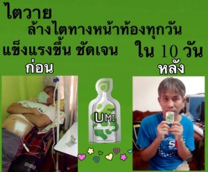 umi-ไตเสื่อม-ฟอกไต-ล้างไต-ไม่อยากฟอกไต-อาหารเสริม-เห็นผล-อูมิ-เอเจล-อาเจล-ราคาถูก-ราคาสมาชิก-สมัครสมาชิก-ตัวแทน-ตัวแทนรายใหญ่-จอยริน-ซื้อ-ไตวาย