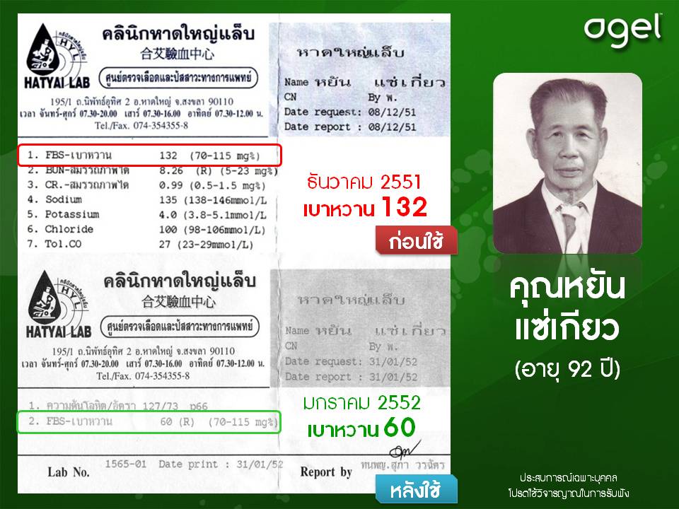 UMI-anti-cancer gelsociety-Kidney-Fucoidan-agel-umi-มะเร็ง-อาเจล-เอเจล-รักษา-ราคาถูก-ราคาสมาชิก-สมัครทำธุรกิจ-ไตเสื่อม-อูมิ-เบาหวาน-ajel-เบาหวาน-คีโม-เพิ่มเม็ดเลือดขาว-cea-กินข้าวไม่ได้-อาหารเสริม-เก๊าส์-umi-grn-agel-uric-acid-อาเจล-ข้อบวม-ยูริค-ยูริก-เก๊าท์-เก๊า-รักษา-ยังไง-หายไหม-อูมิ-อะไรดี-อาหารเสริม-เก๊าท์-ลดกรดยูริค-ปวดข้อ-ปวดเข่า-กรดยูริคสูง-umi-grn-agel-โรคเก๊าท์-ซื้อเอง-ออฟฟิศ-กรุงเทพ-ราคาสมาชิก-สมัคร-ตัวแทน-ทำธุรกิจ-แม่ทีม-ผู้นำระดับสูง-ไตเสื่อม-ไตวาย-ฟอกไต-ไตเรื้อรัง-กินอะไรดี-ผลไม้-ผัก-อาหารเสริม-อะไรดี-เอเจล-umi-agel-ไตเสื่อม-ยารักษาไต-อาหารเสริม-บำรุงไต-อาการ-โรคไต-หายได้ไหม-อาการ-โรคไต-รักษาได้ไหม-รักษาหายไหม-ยารักษาโรคไต-umi-เห็ดหลินจือแดง