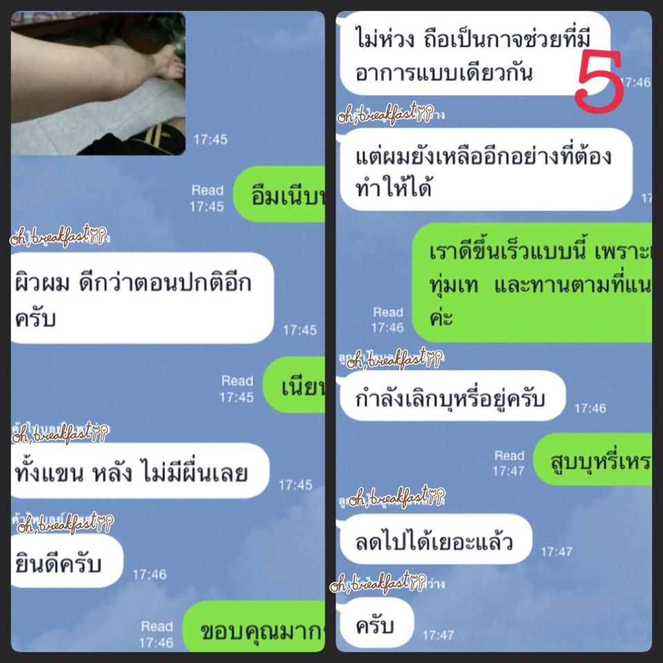 hiv-aids-agel-umi-aids-hiv-cd4-agel-umi-เพิ่ม-อาหารเสริม-คัน-เอดส์-แพ้ยาต้าน-เพิ่มภูมิ-ทานอะไรดี-ซื้อเอง-ออฟฟิศ-กรุงเทพ-ราคาสมาชิก-สมัคร