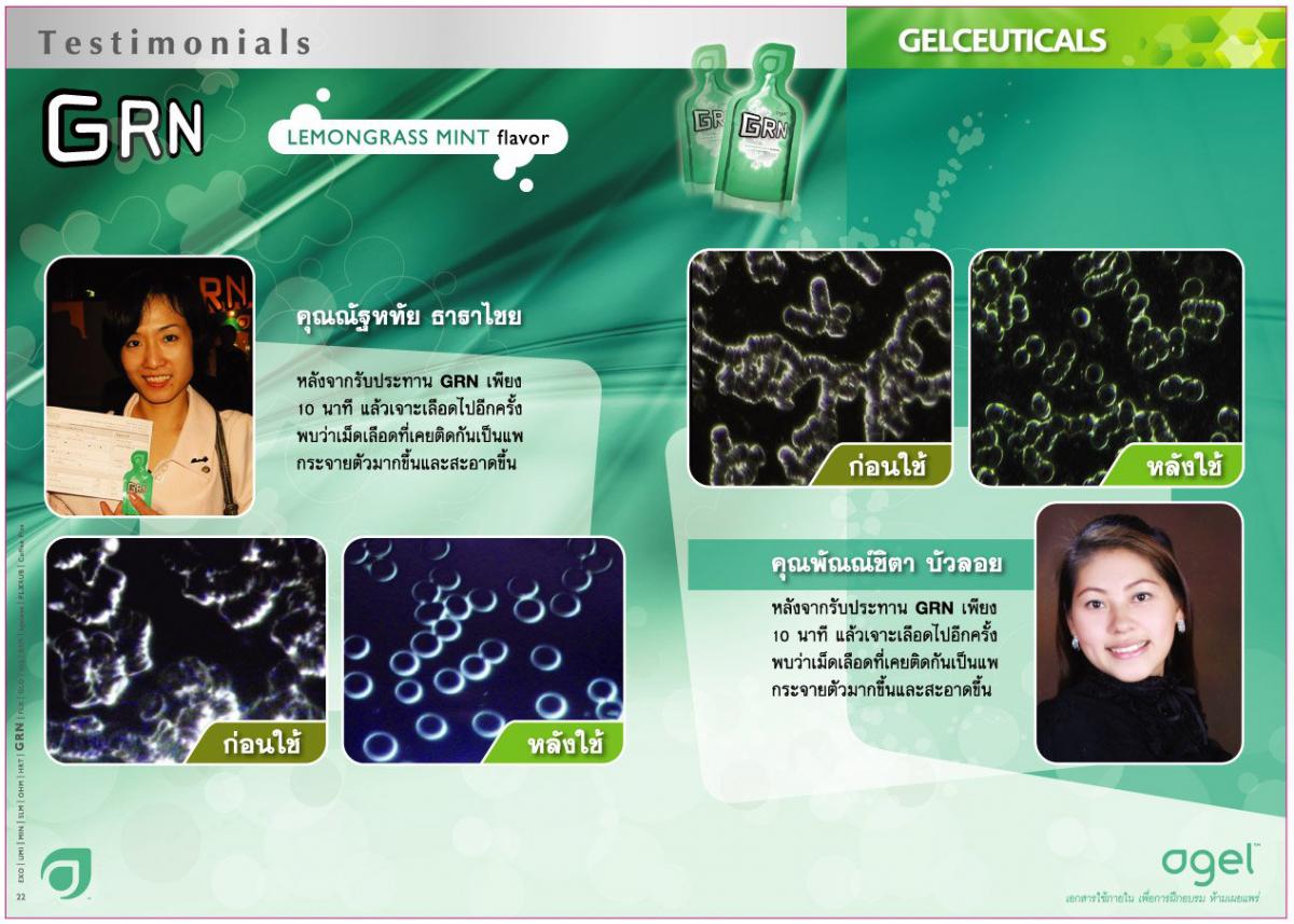 กรดไหลย้อน-agel-detox-ดูดบุหรี่-ล้างสารพิษ-คีเลชั่น-แบบทาน-เลือดหนืด-เลือดข้น-อ่อนเพลีย-ทำงานเยอะ-อะไรบำรุง-กินง่าย-ล้างเลือด-หลังคลอด-เลือดไม่สะอาด