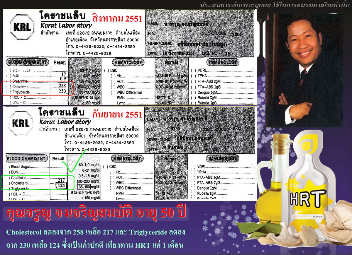 agel-hrt-case-study-agel-hrt-เอเจล-อาเจล-จอย-gel-geltreat-ราคาถูก-ราคาสมาชิก-ฮาร์ท-heart-ไขมันสูง-ไม่อยากทานยา-อาหารเสริม-ผ่านอย-หัวใจตีบ-ความดันสูง-บำรุงหัวใจ-บายพาส-บอลลูน-โคเอ็นไซด์คิวเท็น-coq10-ทอรีน-แอลคาร์นิทีน-เห็ดหอยนางรม-รักษา-โรคหัวใจ-ไม่อยากผ่าตัด-เหนื่อยง่าย-ป้องกันโรคหัวใจ-ไขมันเลว-คอเลสเตอรอลสูง-อยากลดคอเลสเตอรอล-ไม่ทานยา