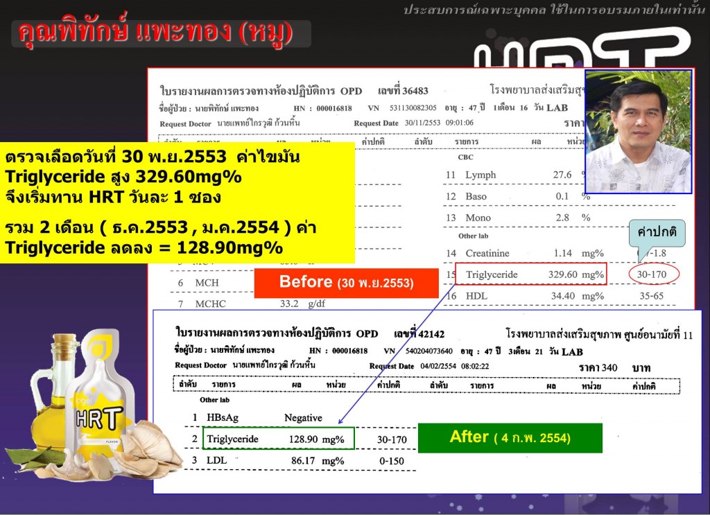 HRT-Case-agel-hrt-เอเจล-อาเจล-จอย-gel-geltreat-ราคาถูก-ราคาสมาชิก-ฮาร์ท-heart-ไขมันสูง-ไม่อยากทานยา-อาหารเสริม-ผ่านอย-หัวใจตีบ-ความดันสูง-บำรุงหัวใจ-บายพาส-บอลลูน-โคเอ็นไซด์คิวเท็น-coq10-ทอรีน-แอลคาร์นิทีน-เห็ดหอยนางรม-รักษา-โรคหัวใจ-ไม่อยากผ่าตัด-เหนื่อยง่าย-ป้องกันโรคหัวใจ