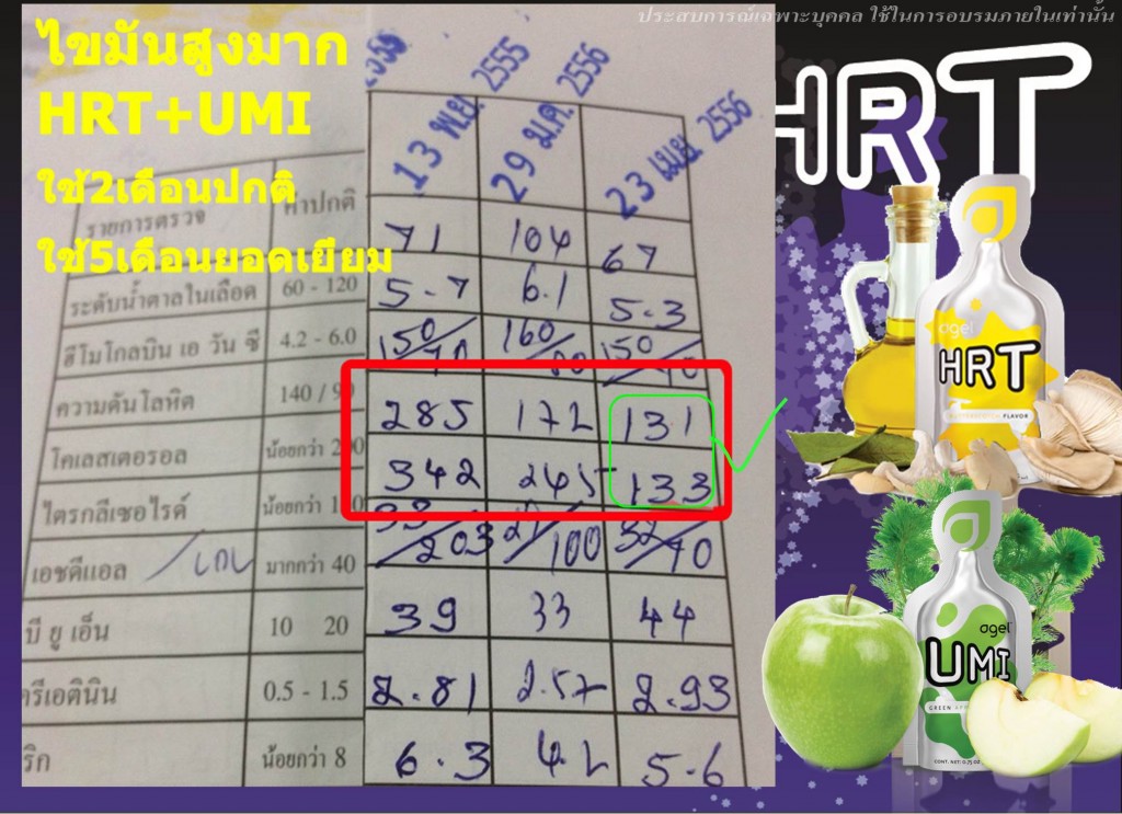 Agel-HRT-LDL-agel-hrt-เอเจล-อาเจล-จอย-gel-geltreat-ราคาถูก-ราคาสมาชิก-ฮาร์ท-heart-ไขมันสูง-ไม่อยากทานยา-อาหารเสริม-ผ่านอย-หัวใจตีบ-ความดันสูง-บำรุงหัวใจ-บายพาส-บอลลูน-โคเอ็นไซด์คิวเท็น-coq10-ทอรีน-แอลคาร์นิทีน-เห็ดหอยนางรม-รักษา-โรคหัวใจ-ไม่อยากผ่าตัด-เหนื่อยง่าย-ป้องกันโรคหัวใจ-ไขมันเลว-คอเลสเตอรอลสูง-อยากลดคอเลสเตอรอล-ไม่ทานยา