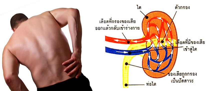 gelsociety-Kidney-Fucoidan-agel-umi-มะเร็ง-อาเจล-เอเจล-รักษา-ราคาถูก-ราคาสมาชิก-สมัครทำธุรกิจ-ไตเสื่อม-อูมิ-เบาหวาน-ajel-เบาหวาน