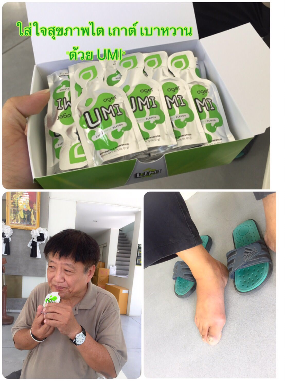 เก๊าส์-umi-grn-agel-uric-acid-อาเจล-ข้อบวม-ยูริค-ยูริก-เก๊าท์-เก๊า-รักษา-ยังไง-หายไหม-อูมิ-อะไรดี-อาหารเสริม-เก๊าท์-ลดกรดยูริค-ปวดข้อ-ปวดเข่า-กรดยูริคสูง-umi-grn-agel-โรคเก๊าท์