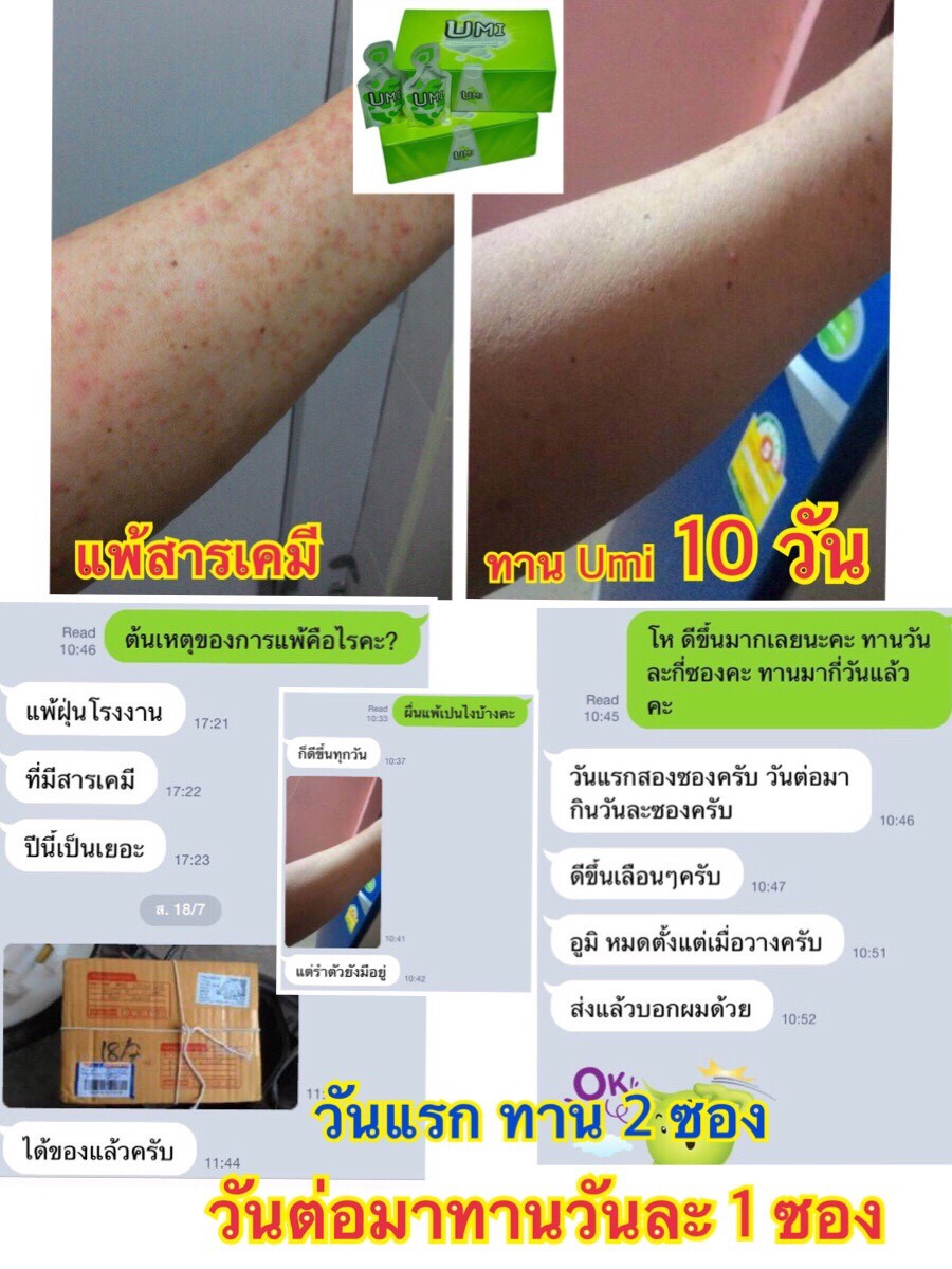 agel-apply-สมัคร-สมาชิก-ซื้อเอง-ทำไง-apply-agel-umi-hrt-min-exo-grn-see-credit-card-ซื้อ-เอเจล-ตัดบัตร-ราคาสมาชิก-จากบริษัท-ไทย-ภูมิแพ้-เพิ่มภูมิ-ภูมิสมดุล-ภูมิต้านทาน-ไม่อยาก-ทานยา-แพ้ง่าย-เด็ก-ไซนัส-หอบ-หืด-หายใจไม่ออก-สารอาหาร-อาหารเสริม-อะไรดี