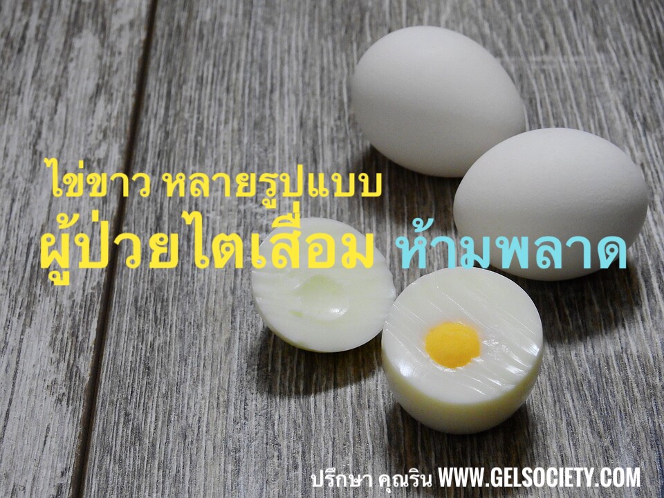 gelsociety-Kidney-Fucoidan-agel-umi-มะเร็ง-อาเจล-เอเจล-รักษา-ราคาถูก-ราคาสมาชิก-สมัครทำธุรกิจ-ไตเสื่อม-อูมิ-เบาหวาน-ajel-เบาหวาน-คีโม-เพิ่มเม็ดเลือดขาว-cea-กินข้าวไม่ได้-อาหารเสริม-เก๊าส์-umi-grn-agel-uric-acid-อาเจล-ข้อบวม-ยูริค-ยูริก-เก๊าท์-เก๊า-รักษา-ยังไง-หายไหม-อูมิ-อะไรดี-อาหารเสริม-เก๊าท์-ลดกรดยูริค-ปวดข้อ-ปวดเข่า-กรดยูริคสูง-umi-grn-agel-โรคเก๊าท์-ซื้อเอง-ออฟฟิศ-กรุงเทพ-ราคาสมาชิก-สมัคร-ตัวแทน-ทำธุรกิจ-แม่ทีม-ผู้นำระดับสูง-ไตเสื่อม-ไตวาย-ฟอกไต-ไตเรื้อรัง-กินอะไรดี-ผลไม้-ผัก--เจ-จอย-ริน-24gel-gel-treat อาหารเสริม-อะไรดี-เอเจล-umi-agel-ไตเสื่อม-ยารักษาไต-อาหารเสริม-บำรุงไต-อาการ-โรคไต-หายได้ไหม-อาการ-โรคไต-รักษาได้ไหม-รักษาหายไหม-ยารักษาโรคไต-umi-เห็ดหลินจือแดง